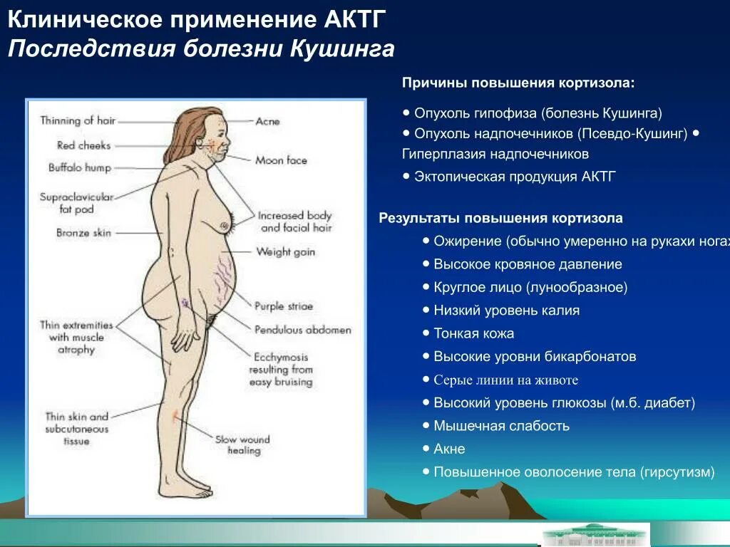 Кортизол повышен у женщины. Болезнь Иценко Кушинга АКТГ. Болезнь Иценко Кушинга АКТГ кортизол. Причины повышения кортизола.