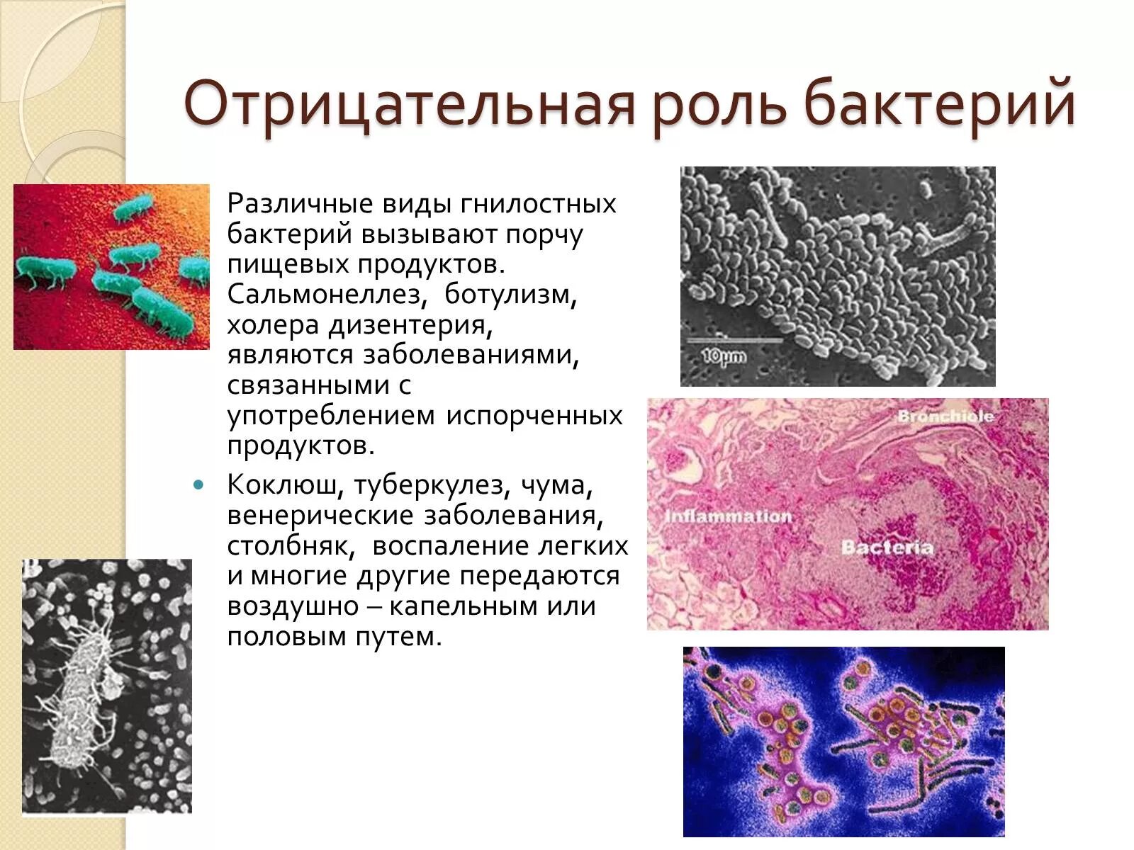 К гнилостным бактериям относятся. Виды вредных бактерий. Полезные и вредные бактерии. Вредные бактерии названия. Вредные бактерии для человека.