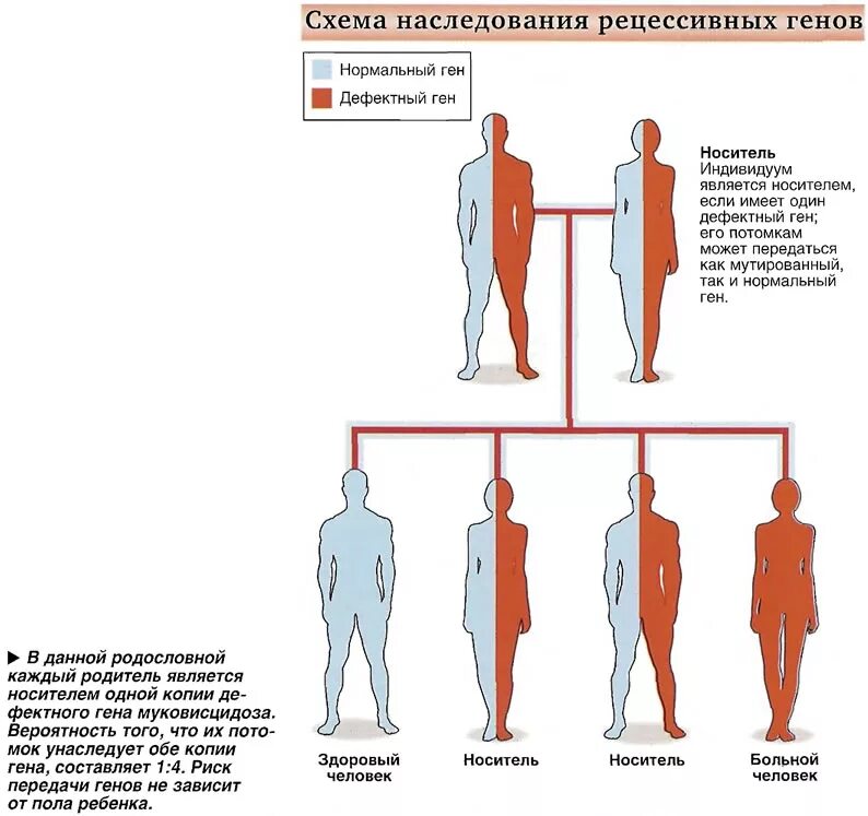 Муковисцидоз Тип наследования. Муковисцидоз схема наследования. Муковисцидоз носитель. Муковисцидоз аутосомно-рецессивное заболевание. Дефектный ген что это такое
