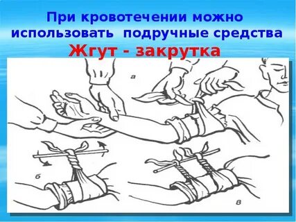 Использование подручных средств остановки кровотечений