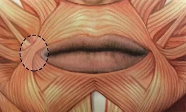 Губы мышцы рта. Модиолус анатомия лица. Резекция dao (мышцы, опускающей угол рта).