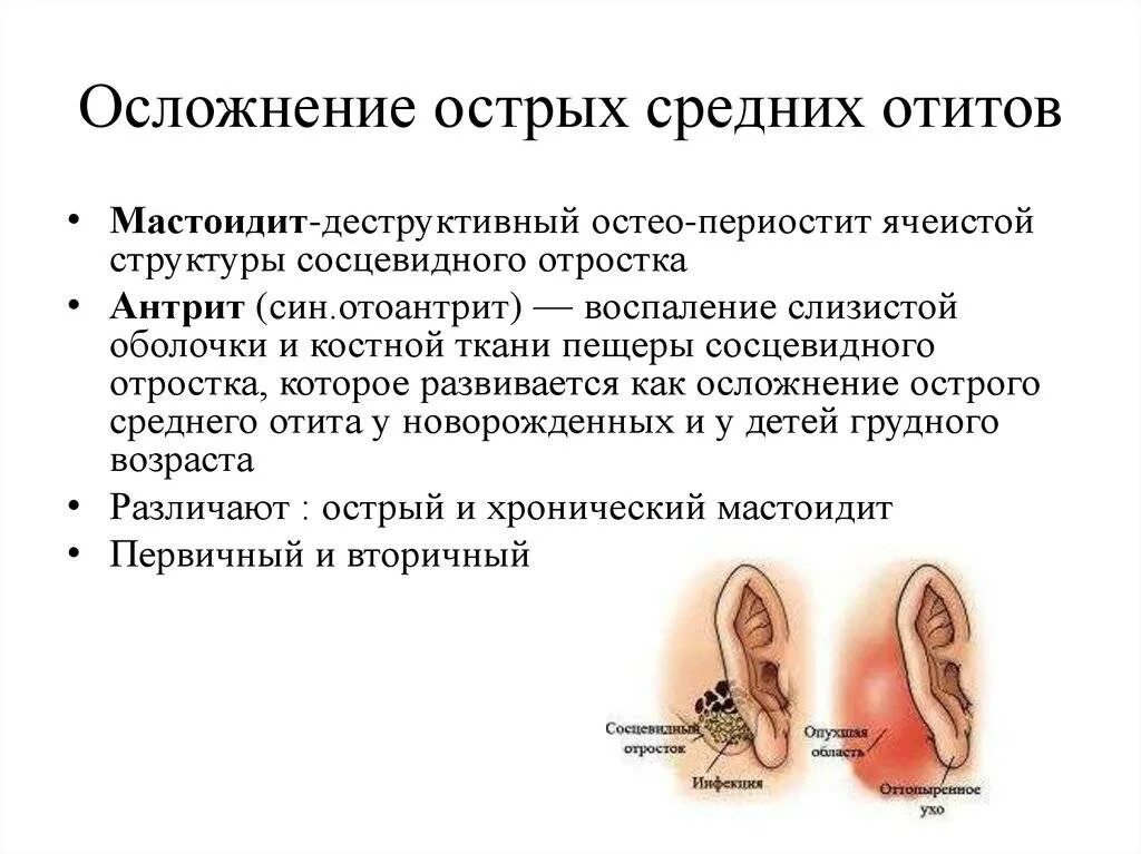 Температура при отите у взрослых