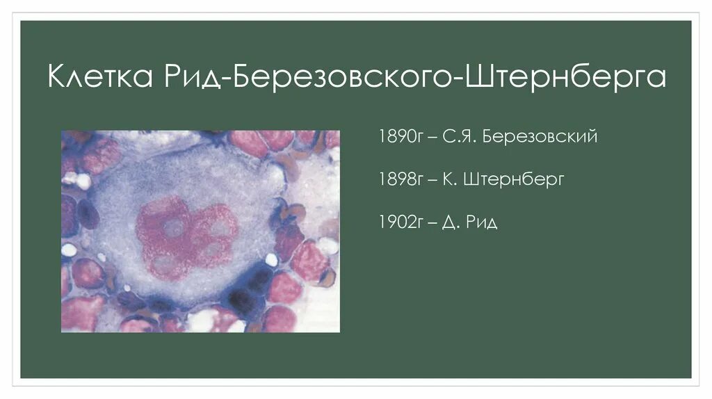 Клетки рида. Клетки Рид-Березовского-Штернберга. Клетки Рида Березовского Штернберга. Морфология клеток Рид-Березовского-Штернберга. Клетки Березовского Штерн.