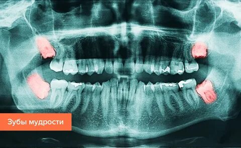 Зачаток восьмерки