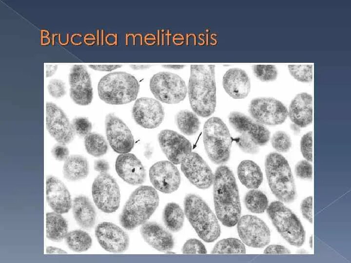 Brucella spp. Brucella abortus микробиология. brucella melitensis микробиология. бруцеллы микроскопия. морфология бруцелл.