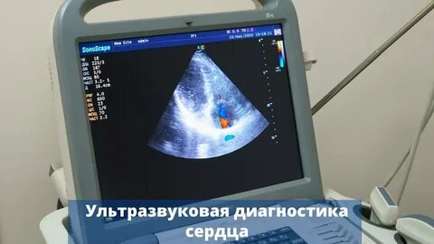 Минск сделать узи сердца платно