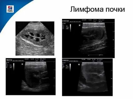 Узи почек у кошек