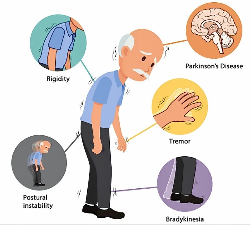 Болезнь Паркинсона. Паркинсон. Болезнь Паркинсона симптомы. Паркинсон проявления. Что такое болезнь паркинсона простыми словами симптомы