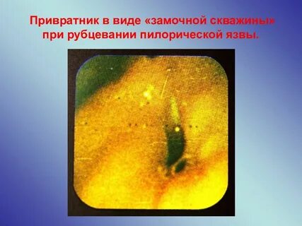 Привратник
