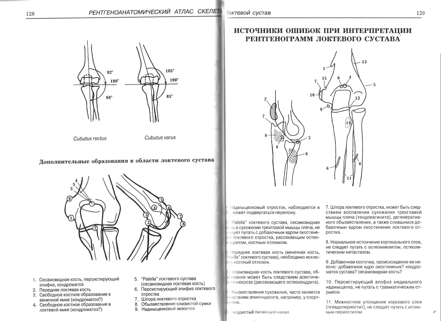 Локтевого мыщелка. Добавочные кости локтевого сустава схема. Ядро окостенения локтевого отростка. Добавочные кости локтевого сустава рентген. Сесамовидная кость коленного сустава схема.