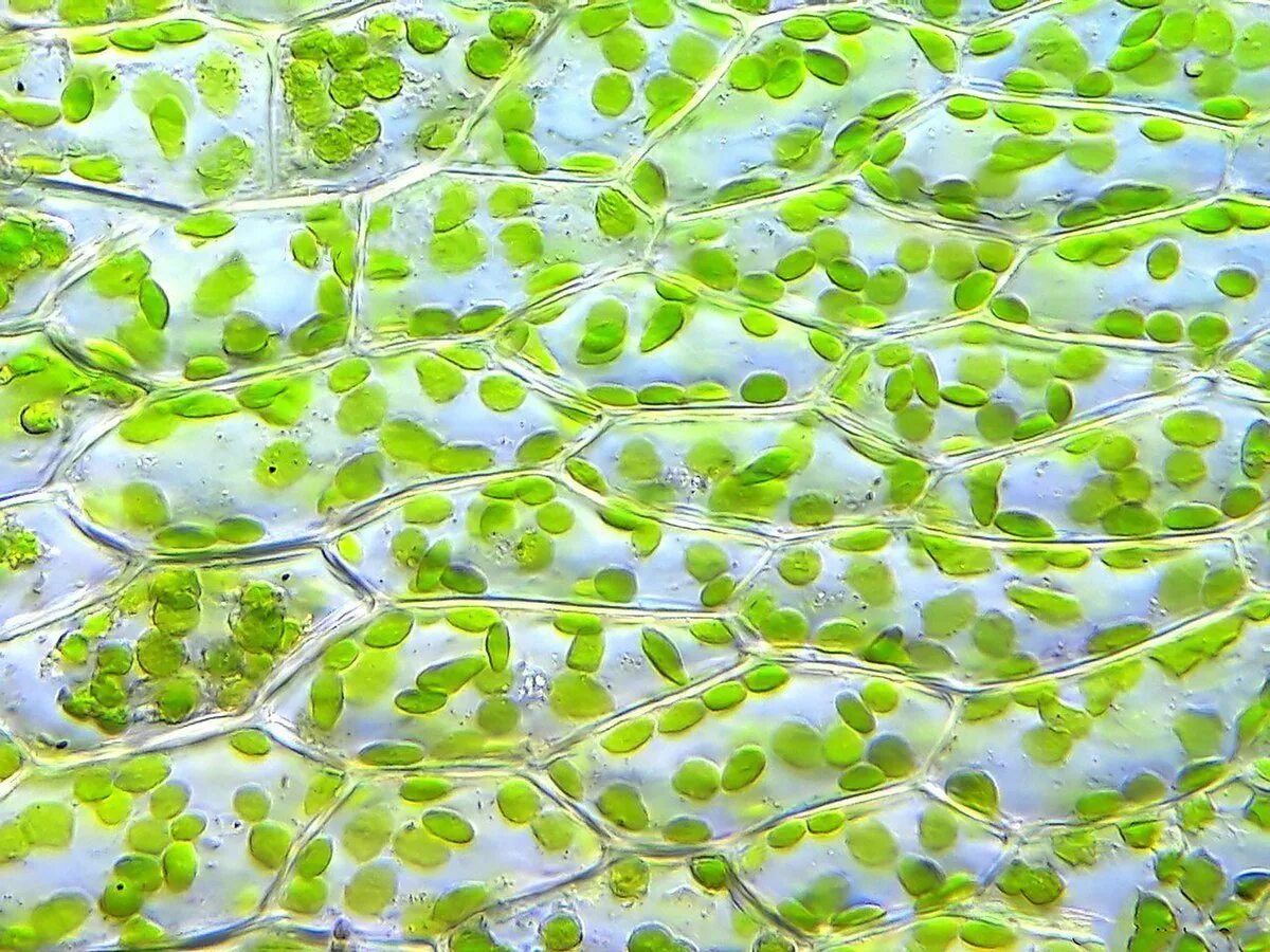 Хлоропласты у водорослей. Элодея хлорофилл. Клетка элодеи хлорофилл. Хлорофилл в клетках растения. Хлоропласты элодеи.