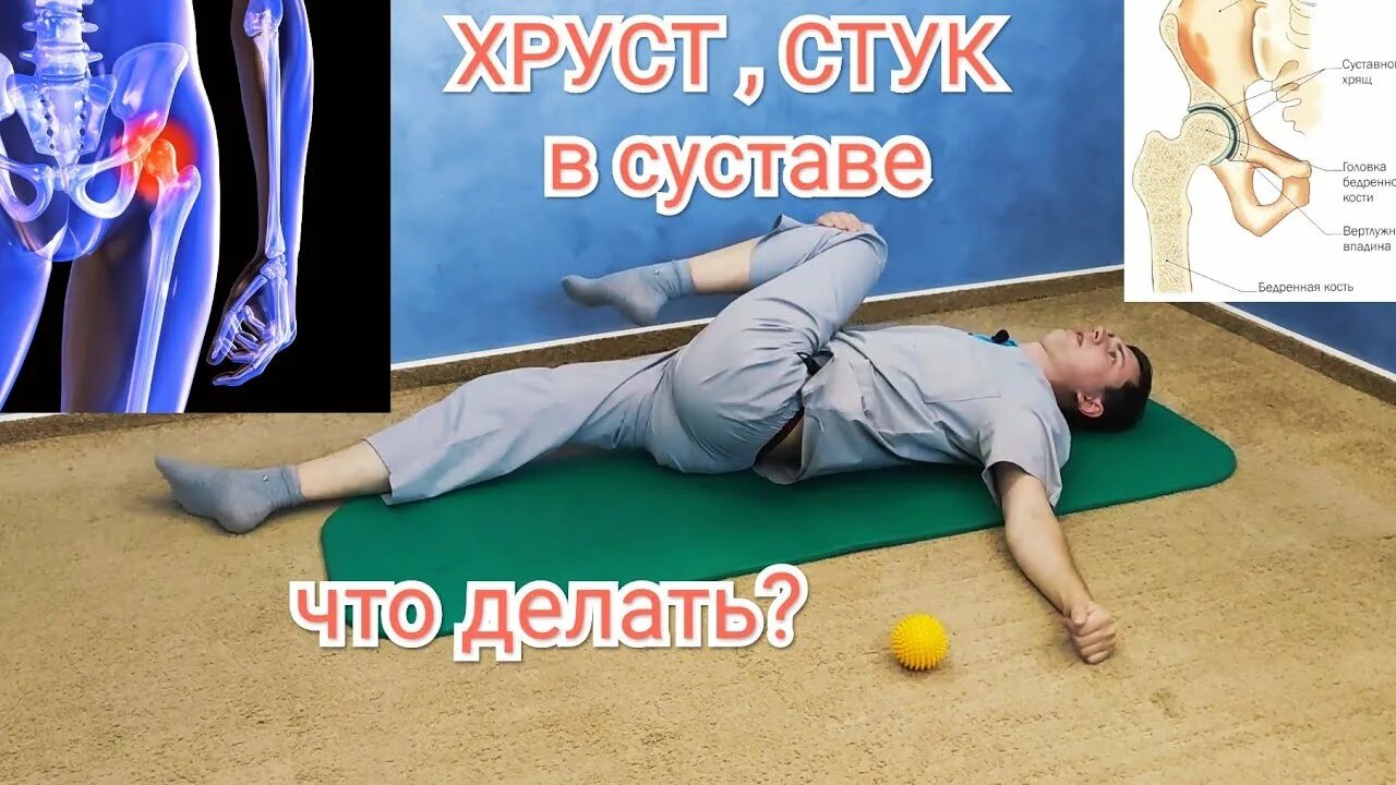 Хруст колена после эндопротезирования. Хруст в тазобедренном суставе. хрустит тазобедренный сустав.