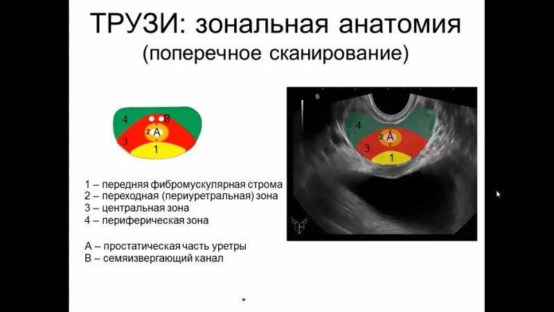 Простаты тюмень. Зональная анатомия предстательной железы УЗИ. УЗИ анатомия предстательной железы трансректально. Изранов УЗИ анатомия предстательной железы. Ультразвуковая анатомия предстательной железы.