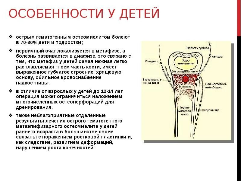 Острый гематогенный остеомиелит схема. Клинические симптомы острого гематогенного остеомиелита. Остеомиелит трубчатых костей. Интрамедуллярной фазы острого гематогенного остеомиелита.