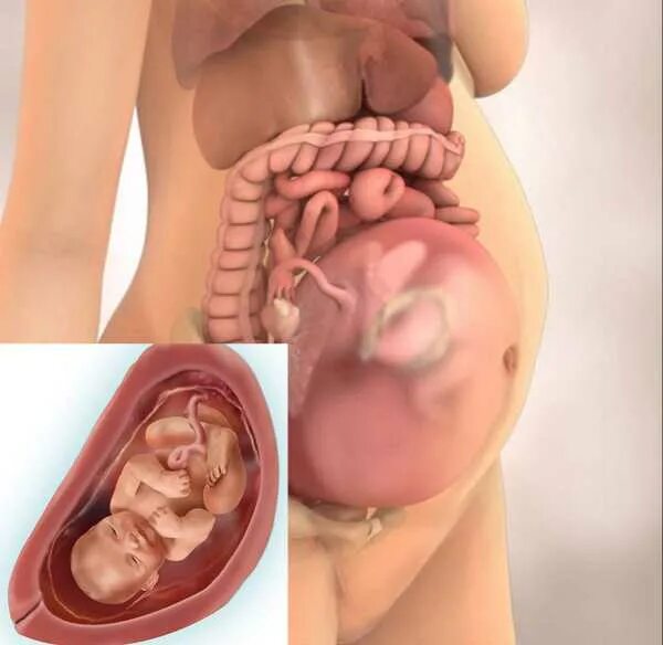 Ребенок в утробе на 33 неделе беременности. Малыш на 28 неделе беременности в утробе. Малыш в 33 недели беременности в животе. Расположение ребенка на 30 неделе беременности. 32 недели беременности сильно