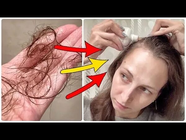 Сон выпала прядь волос. Почему выпадают пряди волос. Как выглядит 100-120 волос выпадающих заьдееь. Невероятный рост волос секрет от трихолога.