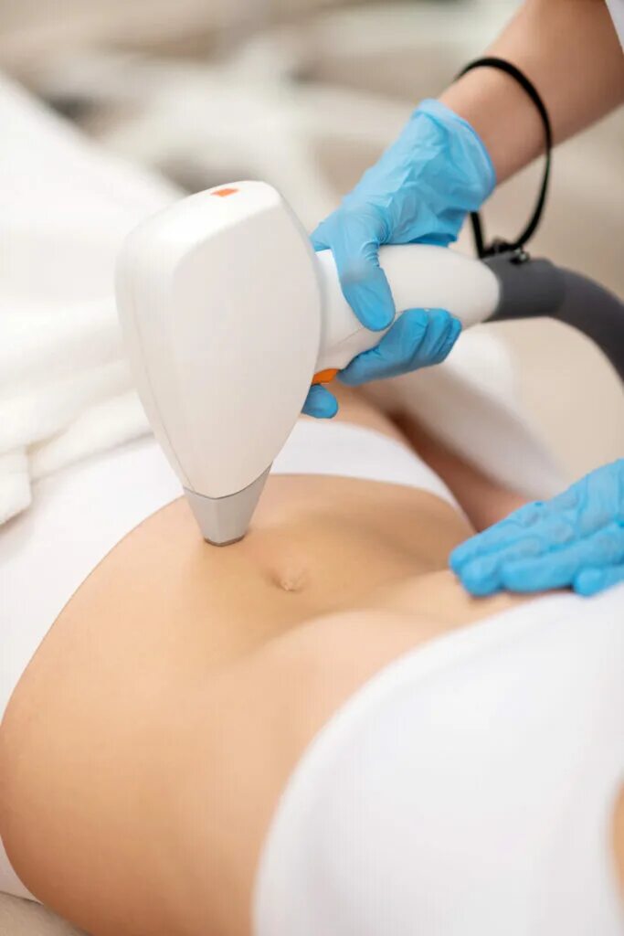 депиляция при беременности можно. депиляция для беременных.