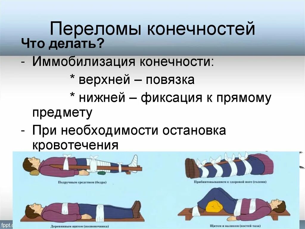 При переломе в первую очередь. Перелом костей ноги иммобилизация. ПМП при переломе костей конечностей. Иммобилизация при открытых переломах. Иммобилизация конечности при переломе.