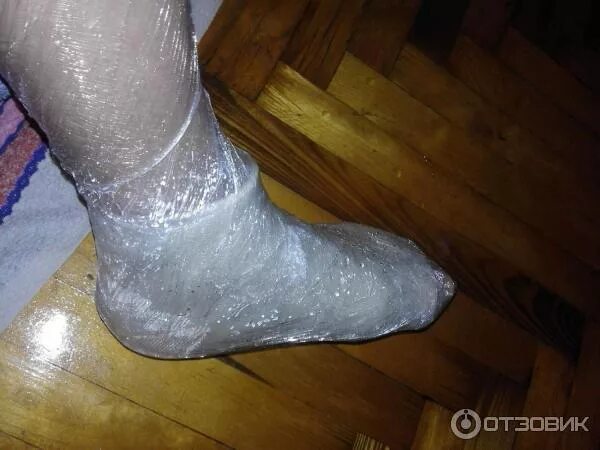 Можно снять гипс чтобы помыться. Чулок на гипс.
