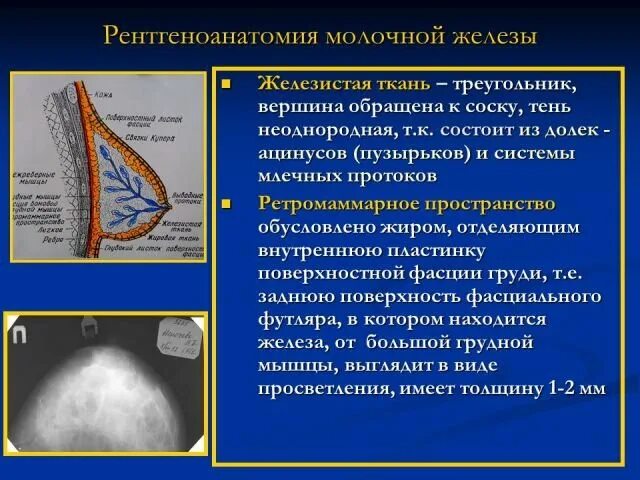 Наука о старости удаление молочной железы. Рентгеноанатомия молочных желез. Нормальная рентгеноанатомия молочной железы. Рентген анатомия молочных желез. Типы строения молочных желёз.