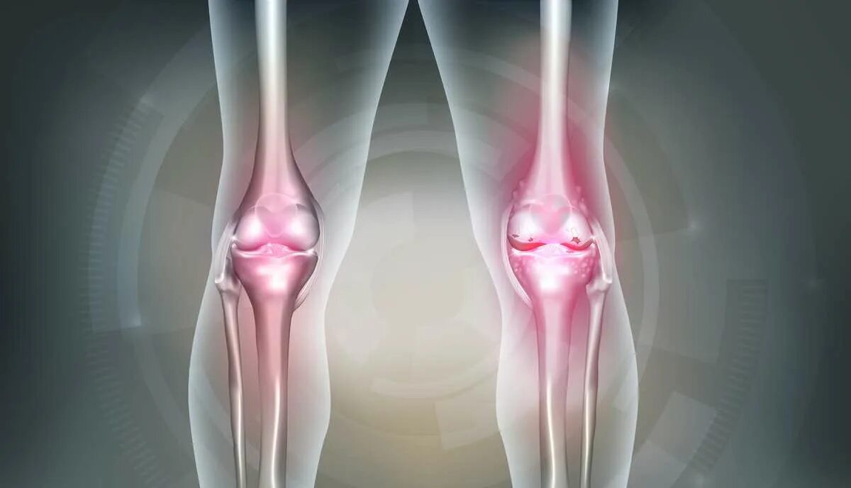 Human join. Красивые ноги — здоровые суставы. human joints. joint pain. human haunch.