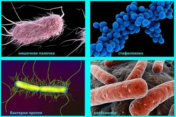 Болезнетворная бактерия палочка. Стафилококки стрептококки кишечная палочка. Кишечная палочка клебсиелла Протей. Стрептококк кишечная палочка. Стафилококк стрептококк Протей.