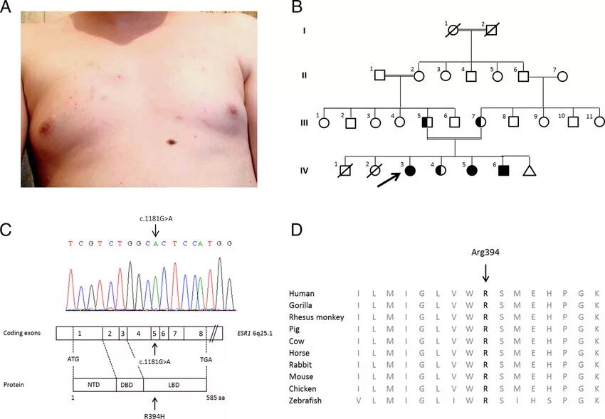 Формула полового развития таблица. Оценка полового развития детей по таннеру. Таннер девочки. Норма полового развития девочки. Стадии таннера для мальчиков.