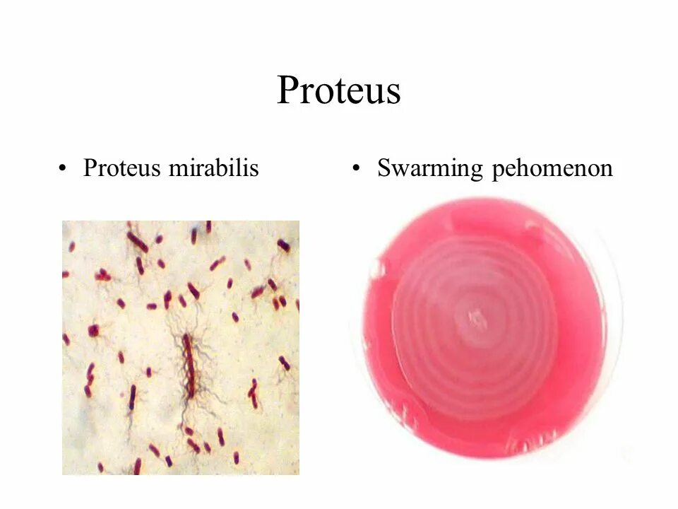 Протей вульгарис микробиология. Протеус бактерия заболевания. Протеи энтеробактерии. Протей бактерия колонии. Proteus mirabilis.