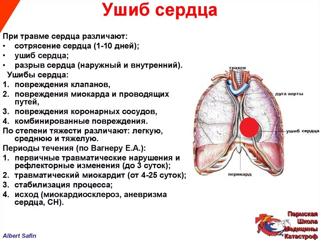 Повреждение миокарда сердца. Ушиб сердца. закрытая травма сердца. повреждения сердца при травмах.