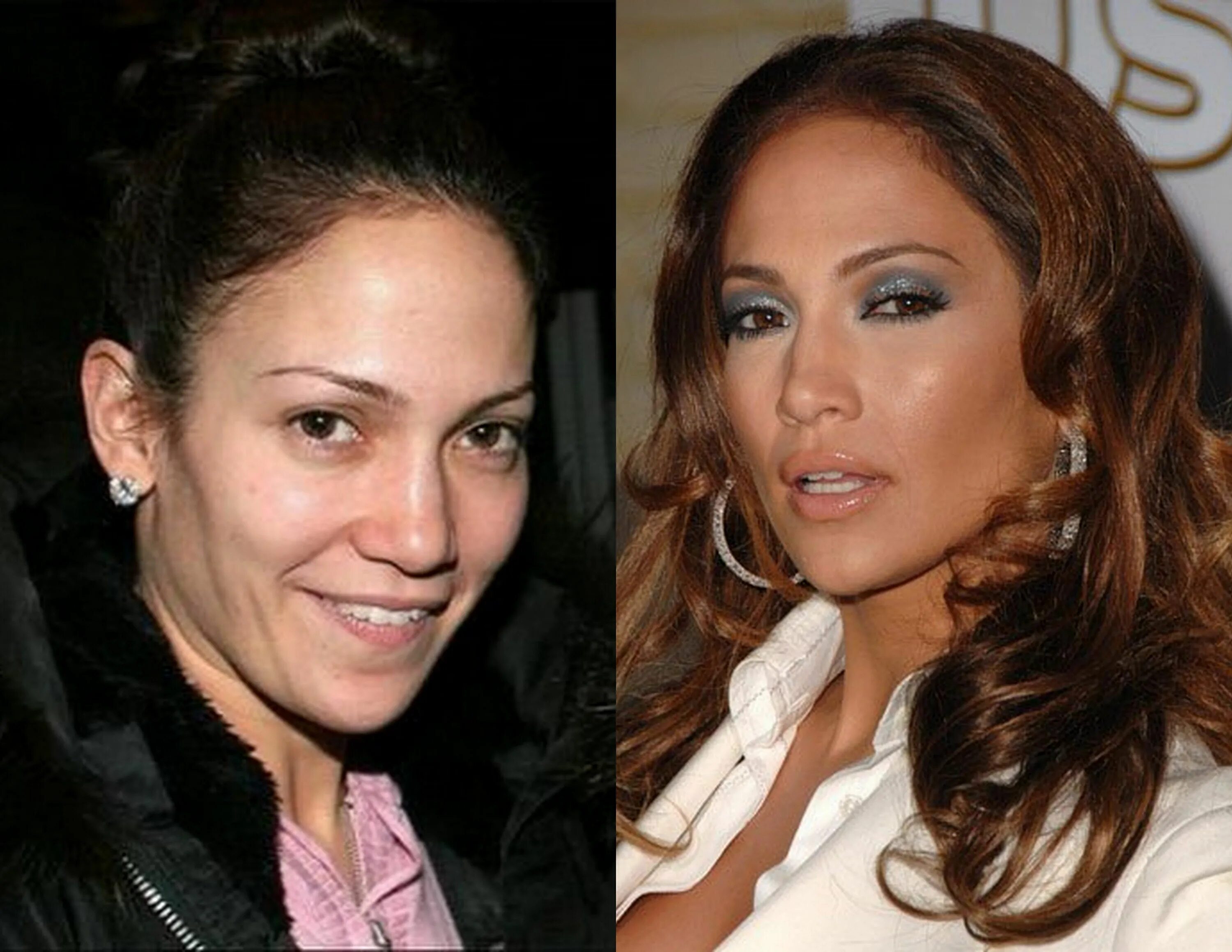 Дженнифер лопес в юности до пластики. Лопес до и после пластики. Лопес до и после пластики. Лопес до и после пластики. Дженнифер лопес ринопластика.