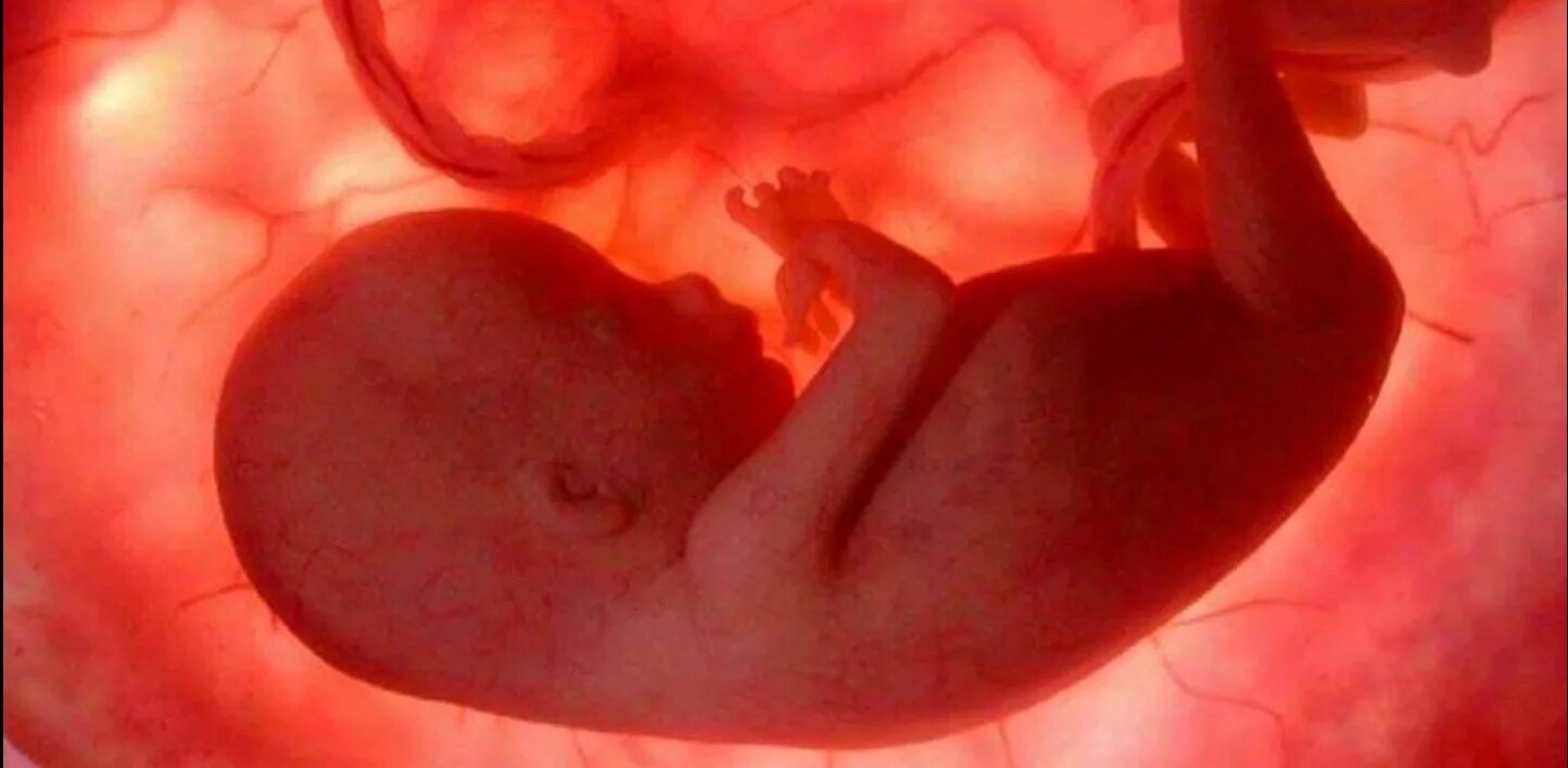 Узи 7 месяцев беременности девочка. Беременная 4 месяца. Ребенок 4 месяца беременной. Ребенок 4 месяца беременной. Плод на 4 месяце беременности.