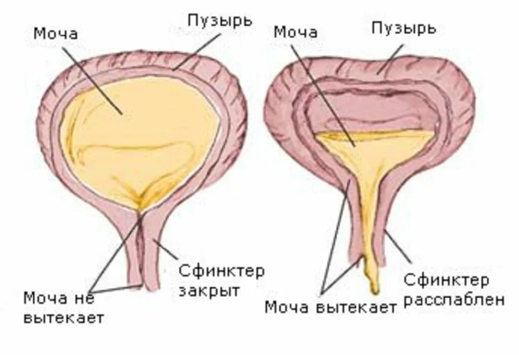 Остаток мочи у мужчин. Мочевой пузырь мочеиспускание. Наполненный мочевой пузырь.