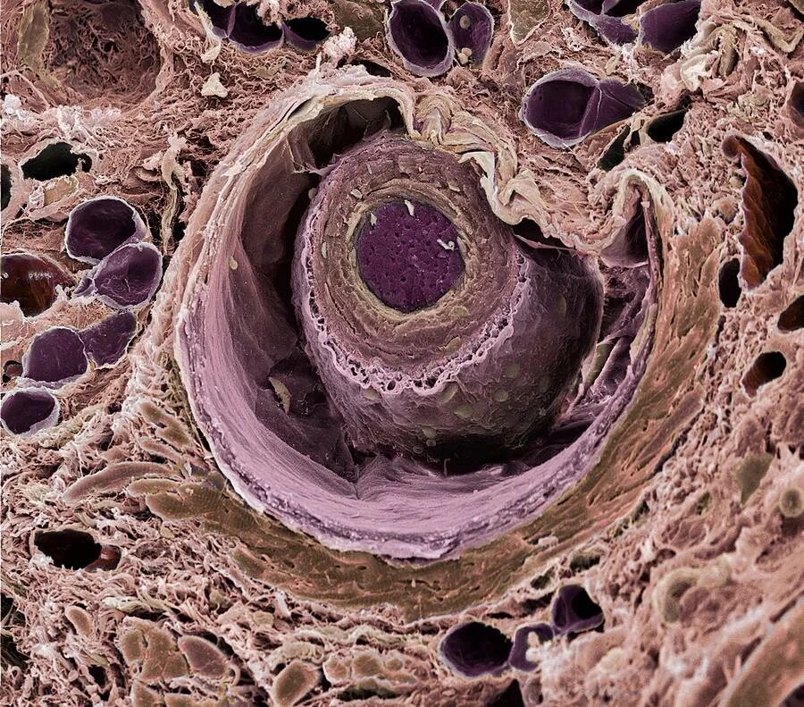 Волос под микроскопом. Человеческий волос под микроскопом. Волосы под микро сеопом. Волос в разрезе под микроскопом.