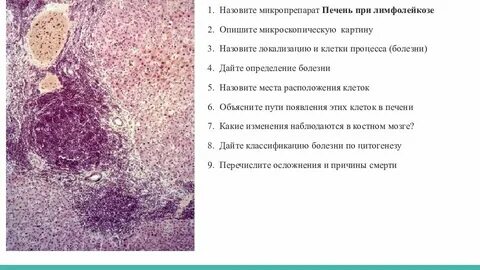 Печень микропрепарат