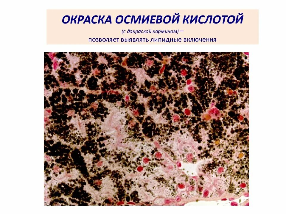 Включения жира в клетках печени аксолотля. Жировые включение в клетках аечени Аксол. Препарат жировые включения в клетках печени аксолотля. Включения гликогена в печени аксолотля.