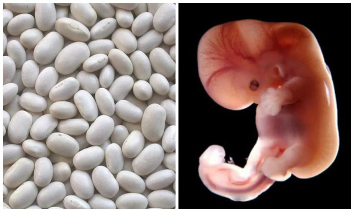 Покажи 7 недель беременности. Плод на 7 неделе беременности. 7 Недель беременности фото плода. Эмбрион 7 недель беременности фото плода. 7 7 Недель беременности фото.