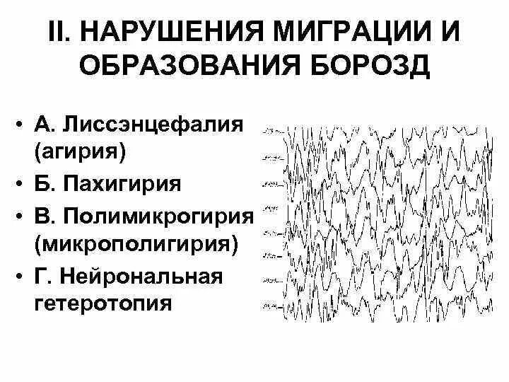 Нарушение миграции