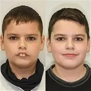 Ортодоника. Ортодоника