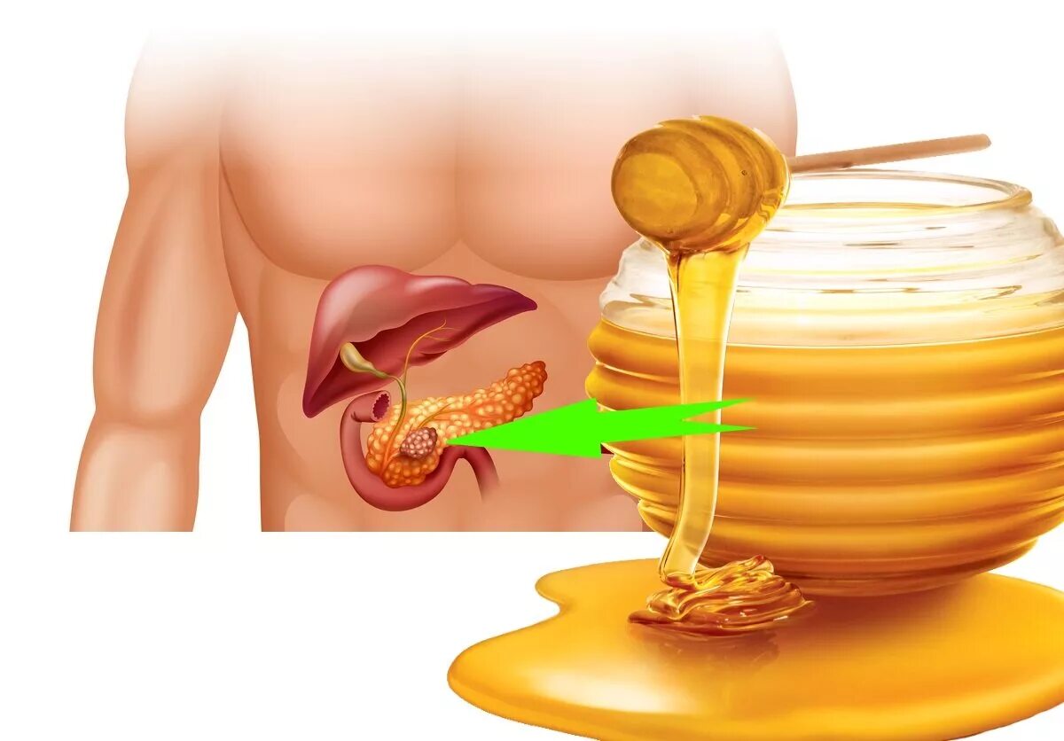 Мед для поджелудочной железы и печени. Мёд и поджелудочная железа. Мед для кишечника и поджелудочной. Мед при панкреатите.