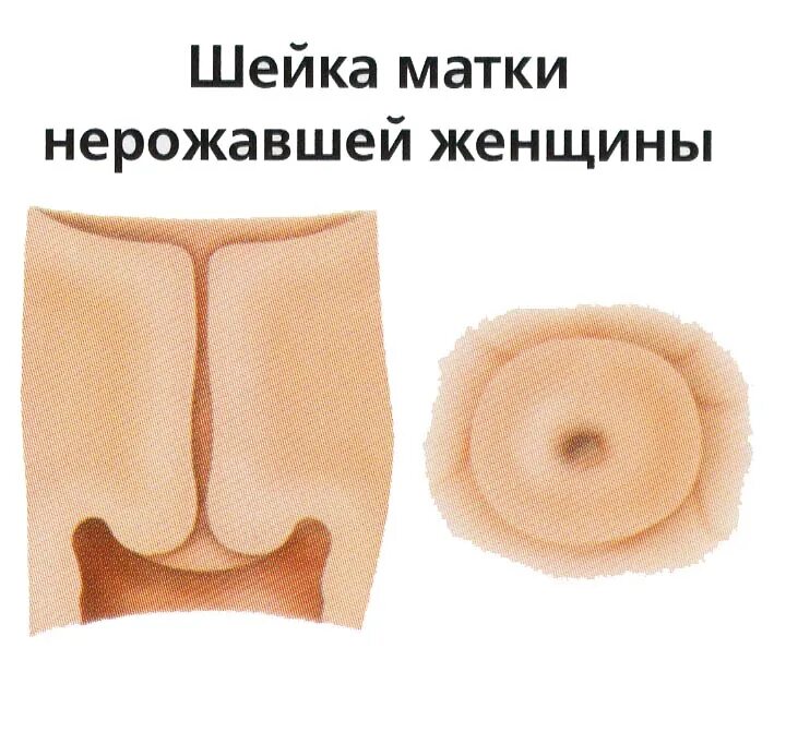Влагалище Нерожавшей Женщины