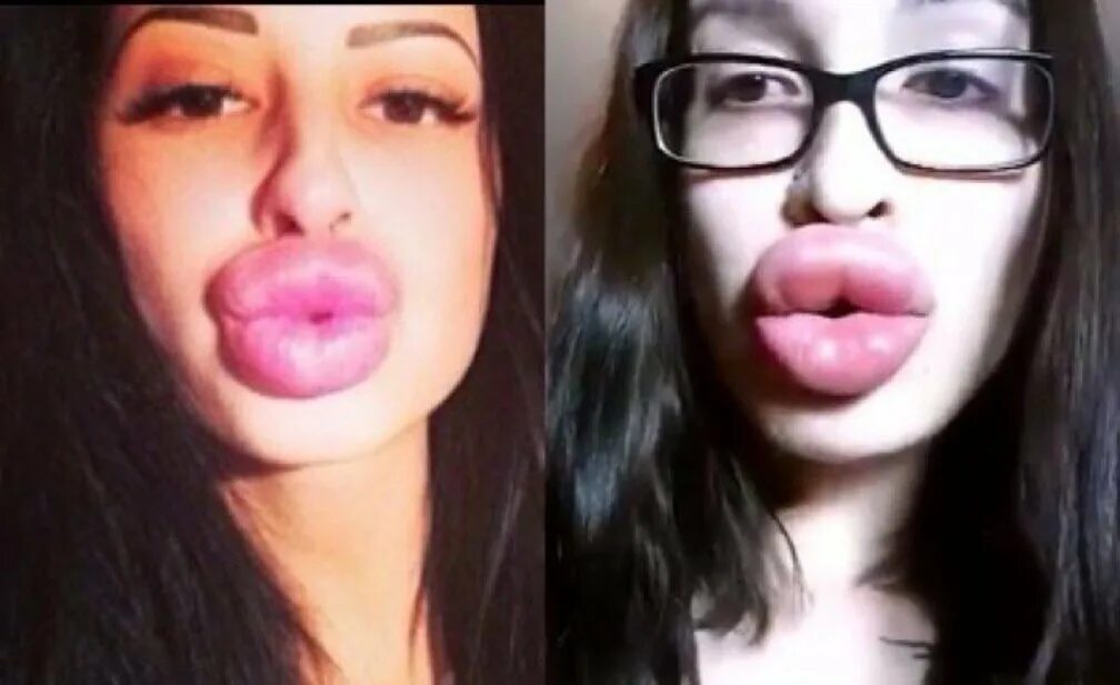 Самы большые накачанные губы. Жесткие губы. Жесткие губы. Кристина рэй губы накаченные. Жесткие губы.