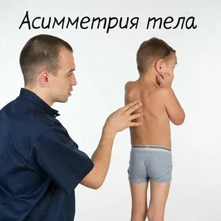 Асимметрия тела