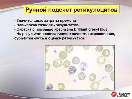 Подсчет ретикулоцитов