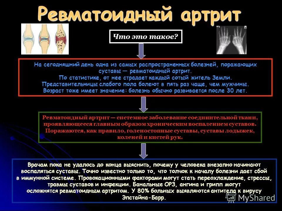 аутоиммунные ревматические заболевания. психосоматика ревматоидный. ревматоидный артриттпсихосоматика. источники психосоматических расстройств. ревматоидный артрит аутоиммунное заболевание.