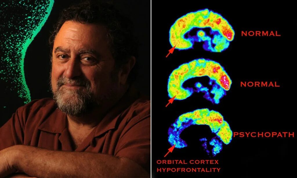 Американский нейробиолог джеймс фэллон. Джим фэллон нейрофизиолог. Фэллон психопат. James fallon психопат. Фэллон психопат.