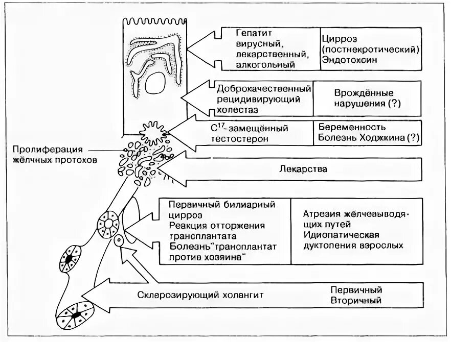 Холестаз классификация. Классификация холестаза. Холестаз схема.