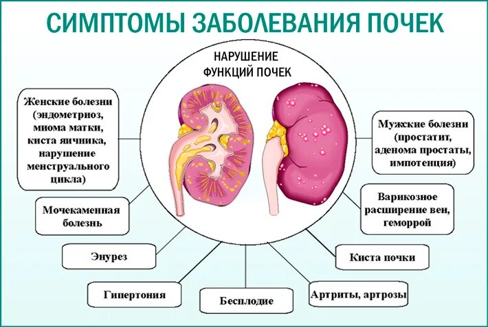 Почка человека симптомы