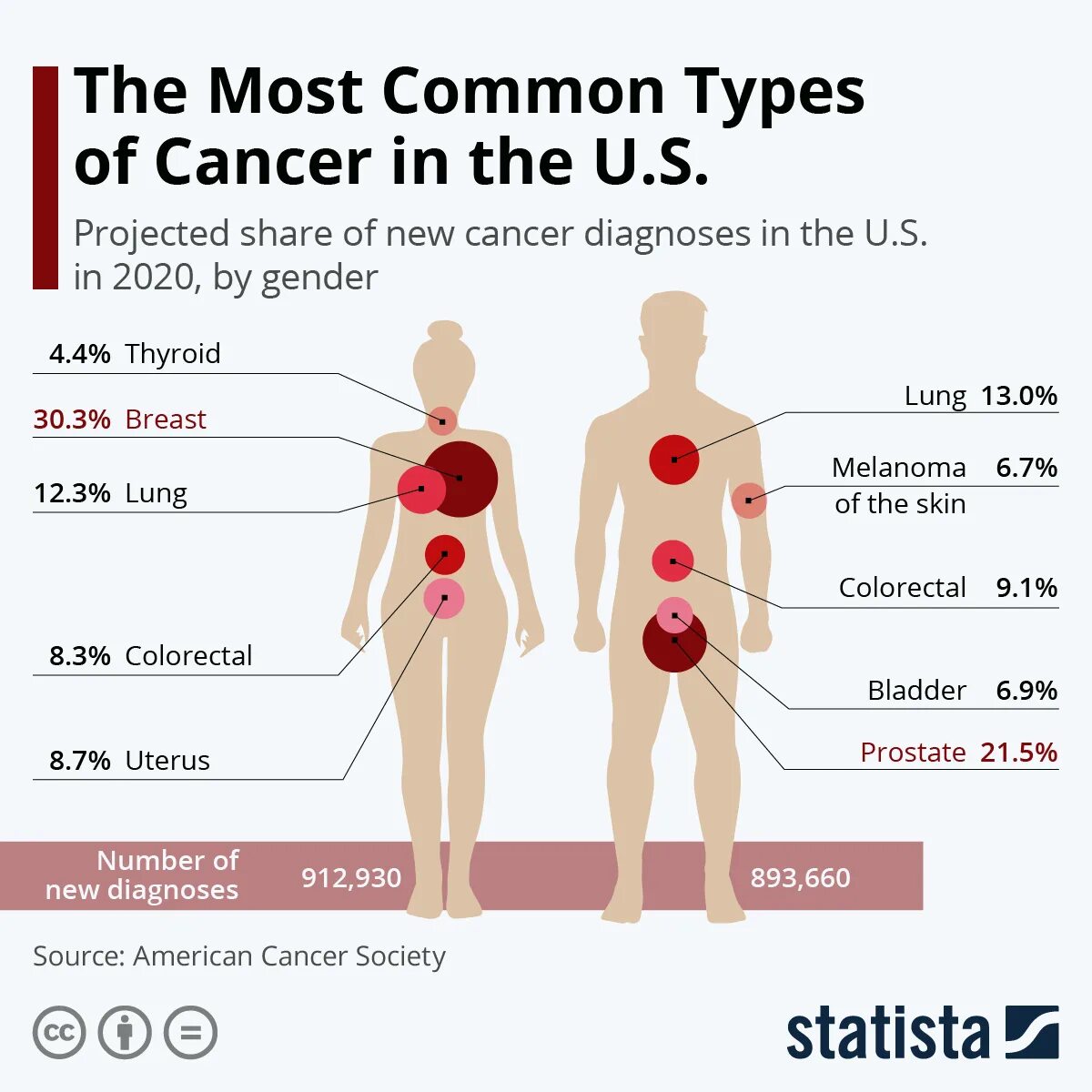 Инфографика онкозаболевание. Онкология у мужчин и женщин. Cancer res