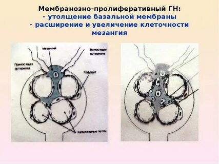 Мезангий клубочков это
