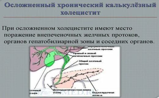 Гепатобилиарная зона что это. Массирование желчного пузыря. Лекарство от загиба желчного пузыря. Желчегонные средства при холецистите. Массаж желчного пузыря при загибе.